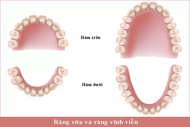 Sự khác nhau giữa răng sữa và răng vĩnh viễn